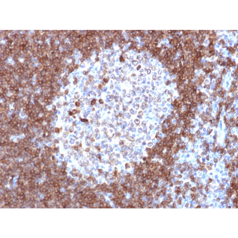 Immunohistochemistry - Anti-CD79a Antibody [JCB117] - BSA and Azide free (A253961) - Antibodies.com