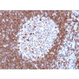 Immunohistochemistry - Anti-CD79a Antibody [JCB117] - BSA and Azide free (A253961) - Antibodies.com