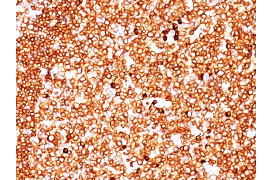 Immunohistochemistry - Anti-CD79a Antibody [SPM549] - BSA and Azide free (A253962) - Antibodies.com