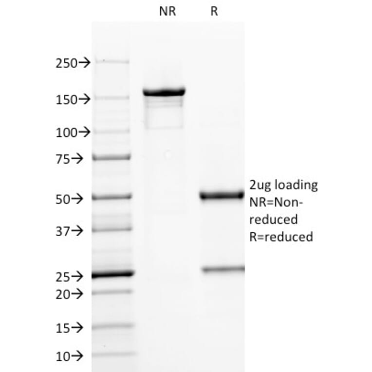 SDS-PAGE - Anti-CD79a Antibody [HM47/A9] - BSA and Azide free (A253963) - Antibodies.com
