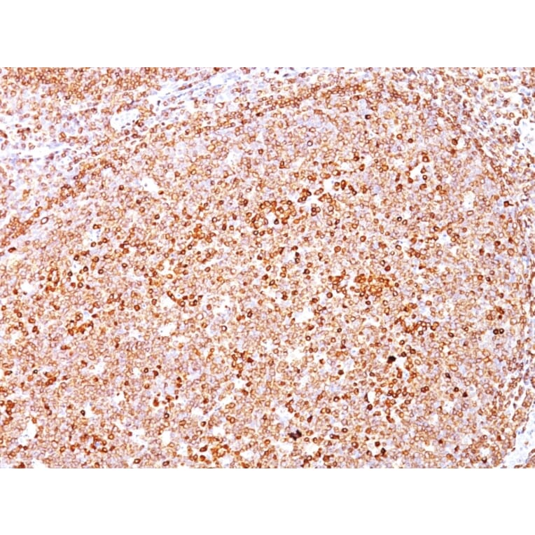 Immunohistochemistry - Anti-CD79a Antibody [SPM550] - BSA and Azide free (A253964) - Antibodies.com