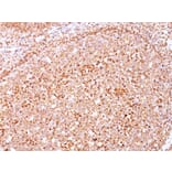 Immunohistochemistry - Anti-CD79a Antibody [SPM550] - BSA and Azide free (A253964) - Antibodies.com