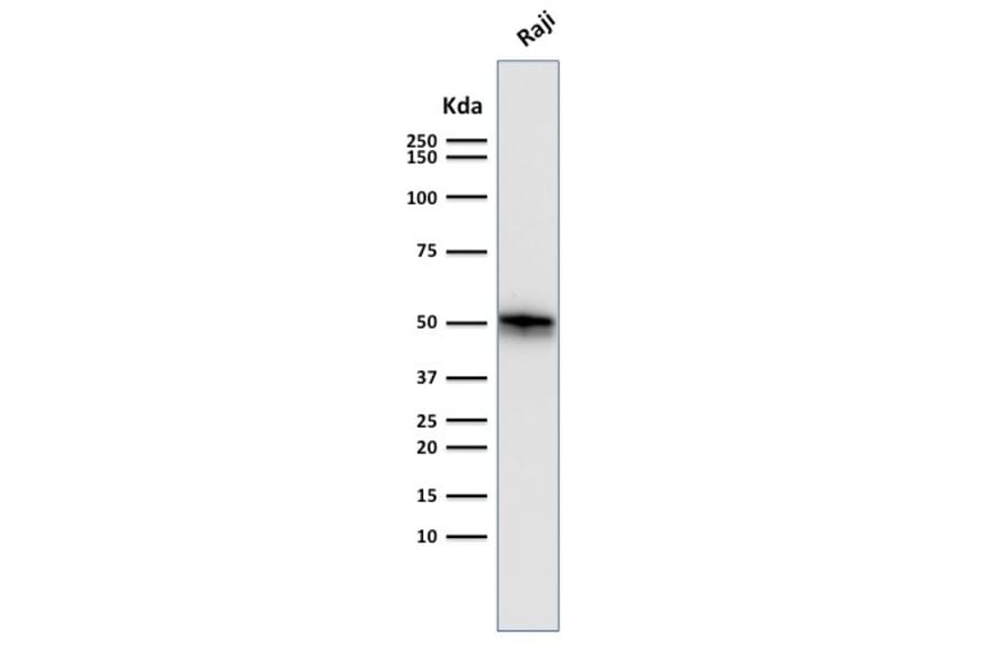 Western Blot - Anti-CD79a Antibody [SPM550] - BSA and Azide free (A253964) - Antibodies.com