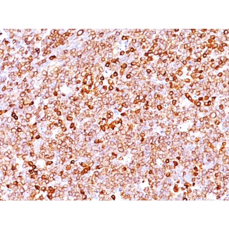 Immunohistochemistry - Anti-CD79a Antibody [JCB117 + HM47/A9] - BSA and Azide free (A253965) - Antibodies.com