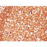 Immunohistochemistry - Anti-CD79a Antibody [JCB117 + HM47/A9] - BSA and Azide free (A253965) - Antibodies.com