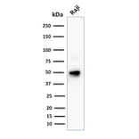 Western Blot - Anti-CD79a Antibody [JCB117 + HM47/A9] - BSA and Azide free (A253965) - Antibodies.com
