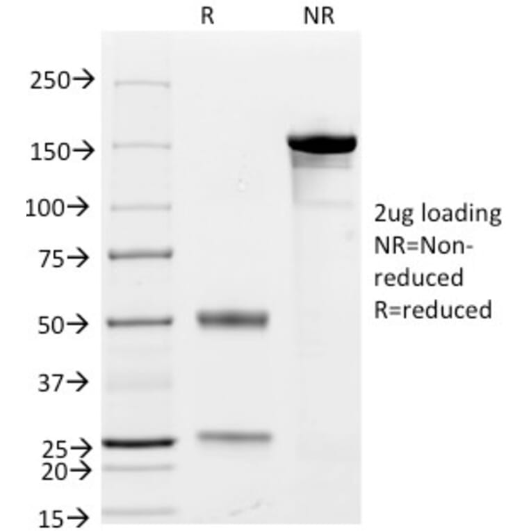 SDS-PAGE - Anti-CD79a Antibody [JCB117 + HM47/A9] - BSA and Azide free (A253965) - Antibodies.com