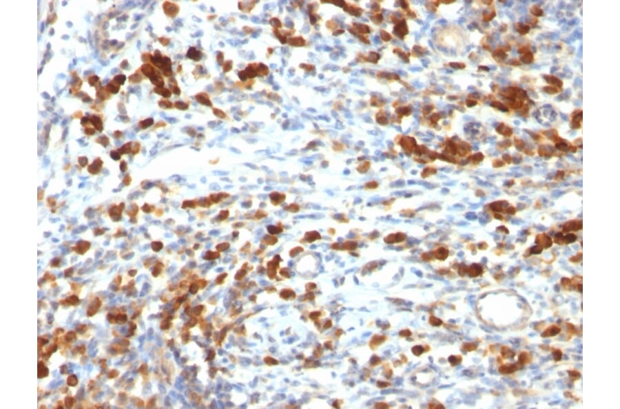 Immunohistochemistry - Anti-CD79a Antibody [IGA/764] - BSA and Azide free (A253966) - Antibodies.com