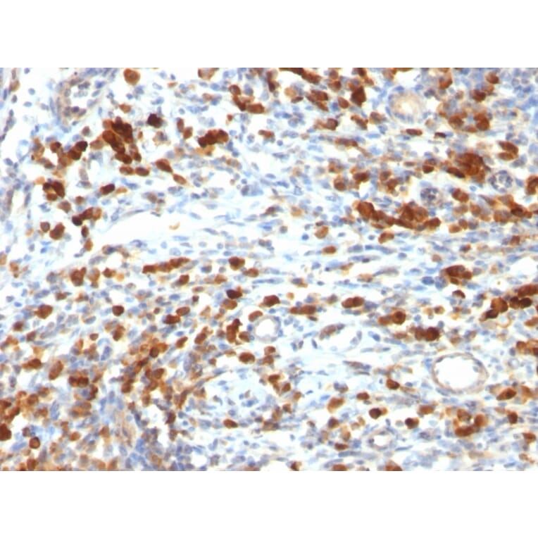 Immunohistochemistry - Anti-CD79a Antibody [IGA/764] - BSA and Azide free (A253966) - Antibodies.com
