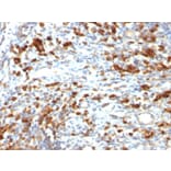 Immunohistochemistry - Anti-CD79a Antibody [IGA/764] - BSA and Azide free (A253966) - Antibodies.com