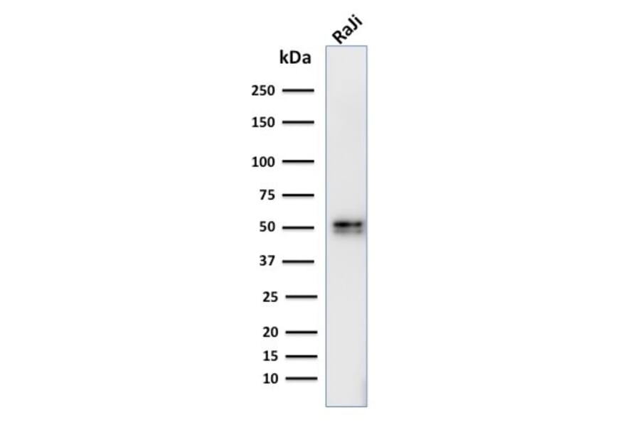 Western Blot - Anti-CD79a Antibody [IGA/764] - BSA and Azide free (A253966) - Antibodies.com