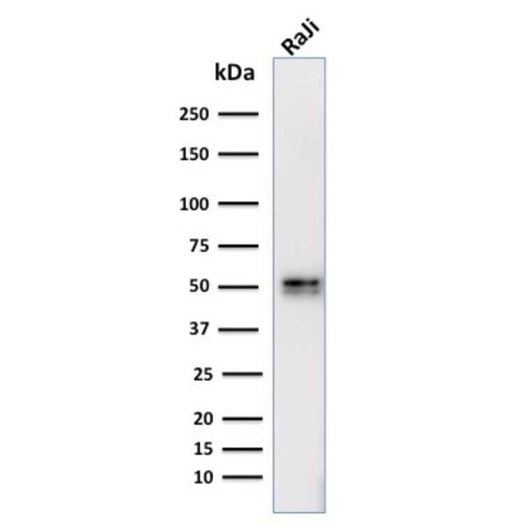 Western Blot - Anti-CD79a Antibody [IGA/764] - BSA and Azide free (A253966) - Antibodies.com