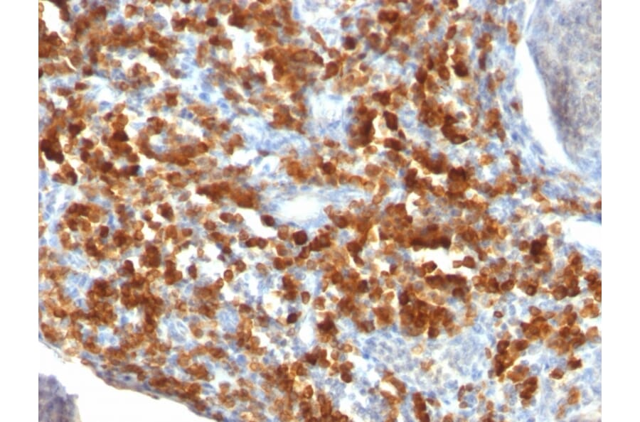 Immunohistochemistry - Anti-CD79a Antibody [IGA/515] - BSA and Azide free (A253967) - Antibodies.com