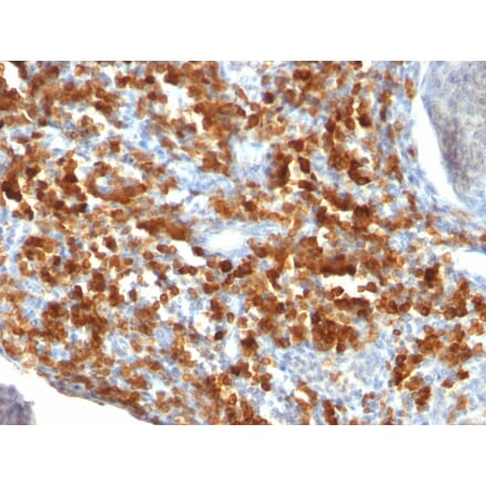 Immunohistochemistry - Anti-CD79a Antibody [IGA/515] - BSA and Azide free (A253967) - Antibodies.com
