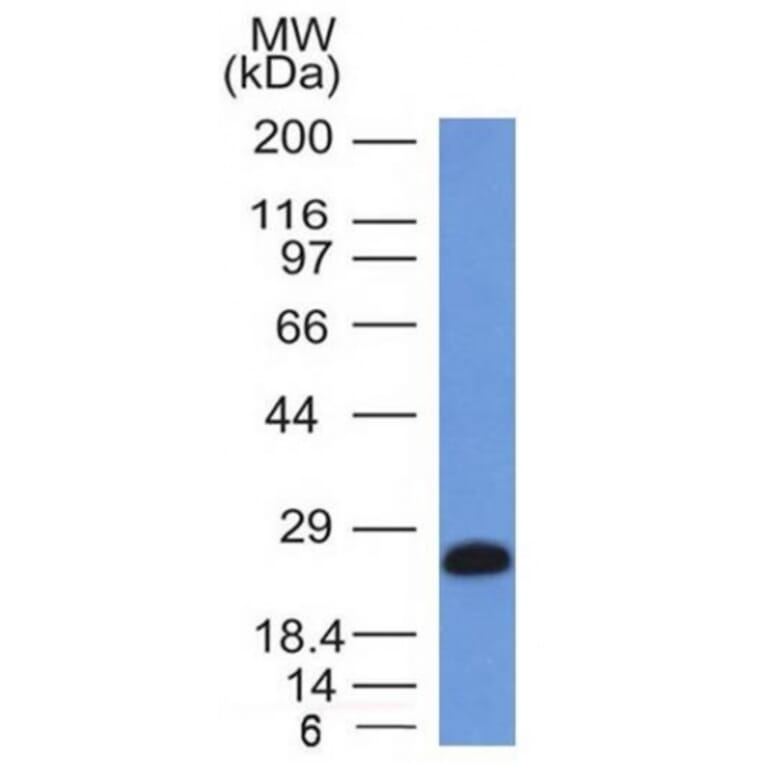 Western Blot - Anti-CD79a Antibody [IGA/1406] - BSA and Azide free (A253968) - Antibodies.com