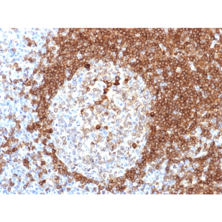 Immunohistochemistry - Anti-CD79a Antibody [HM57] - BSA and Azide free (A253969) - Antibodies.com