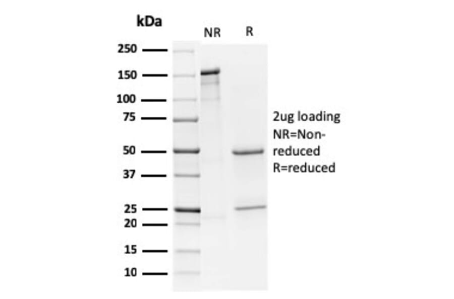 SDS-PAGE - Anti-CD79a Antibody [HM57] - BSA and Azide free (A253969) - Antibodies.com