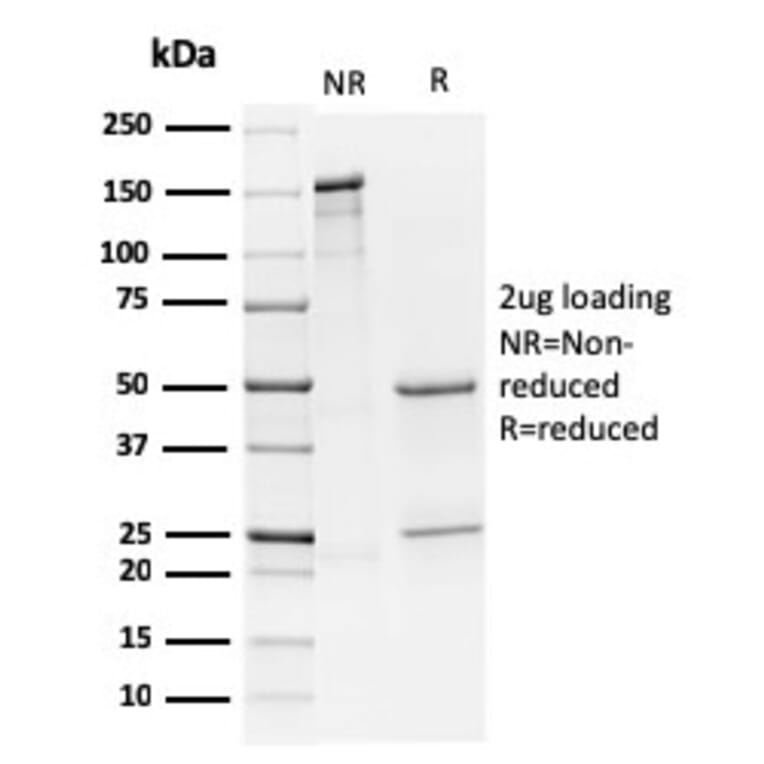 SDS-PAGE - Anti-CD79a Antibody [HM57] - BSA and Azide free (A253969) - Antibodies.com
