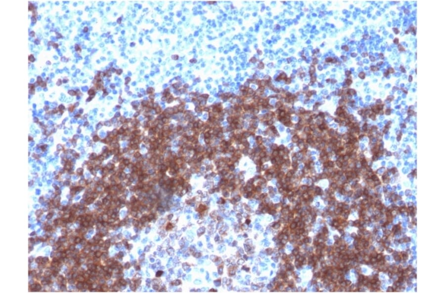 Immunohistochemistry - Anti-CD79a Antibody [IGA/1790R] - BSA and Azide free (A253970) - Antibodies.com