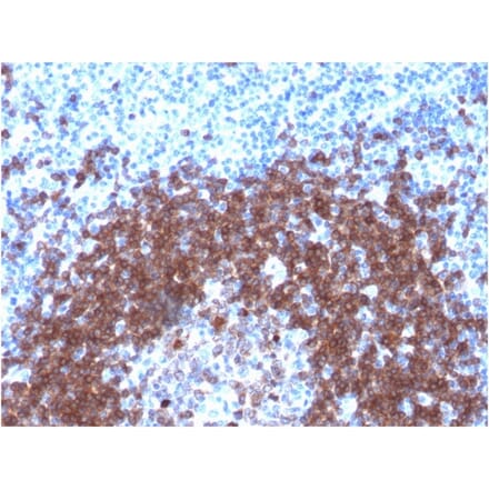 Immunohistochemistry - Anti-CD79a Antibody [IGA/1790R] - BSA and Azide free (A253970) - Antibodies.com
