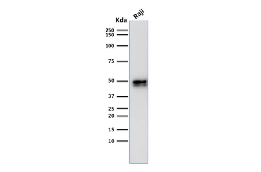 Western Blot - Anti-CD79a Antibody [IGA/1790R] - BSA and Azide free (A253970) - Antibodies.com
