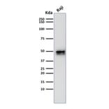 Western Blot - Anti-CD79a Antibody [IGA/1790R] - BSA and Azide free (A253970) - Antibodies.com