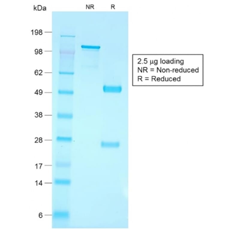 SDS-PAGE - Anti-CD79a Antibody [IGA/1790R] - BSA and Azide free (A253970) - Antibodies.com