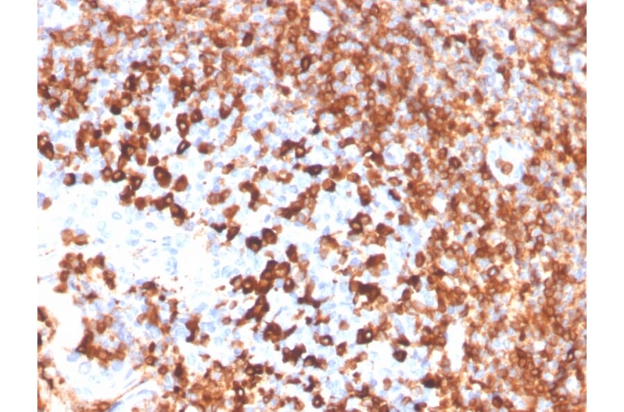 Immunohistochemistry - Anti-CD79a Antibody [IGA/3939R] - BSA and Azide free (A253971) - Antibodies.com