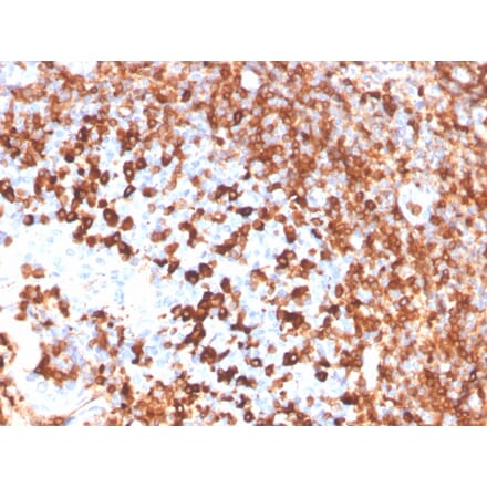 Immunohistochemistry - Anti-CD79a Antibody [IGA/3939R] - BSA and Azide free (A253971) - Antibodies.com