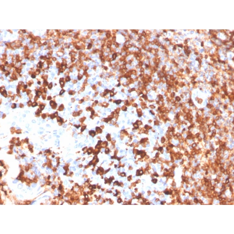 Immunohistochemistry - Anti-CD79a Antibody [IGA/3939R] - BSA and Azide free (A253971) - Antibodies.com