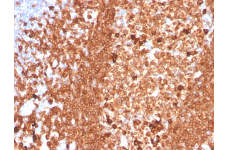 Immunohistochemistry - Anti-CD79a Antibody [IGA/3939R] - BSA and Azide free (A253970) - Antibodies.com