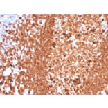 Immunohistochemistry - Anti-CD79a Antibody [IGA/3939R] - BSA and Azide free (A253970) - Antibodies.com