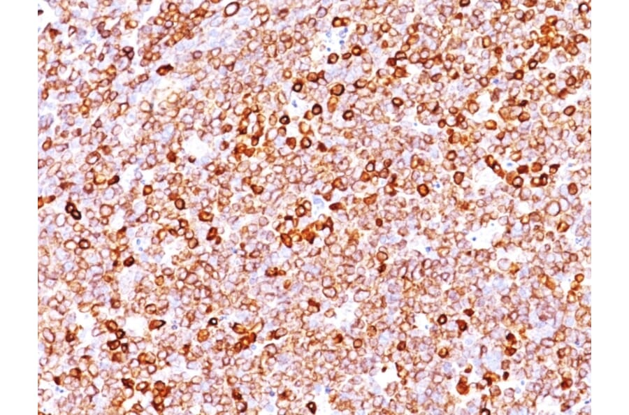 Immunohistochemistry - Anti-CD79a Antibody [IGA/1688R] - BSA and Azide free (A253972) - Antibodies.com