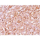 Immunohistochemistry - Anti-CD79a Antibody [IGA/1688R] - BSA and Azide free (A253972) - Antibodies.com