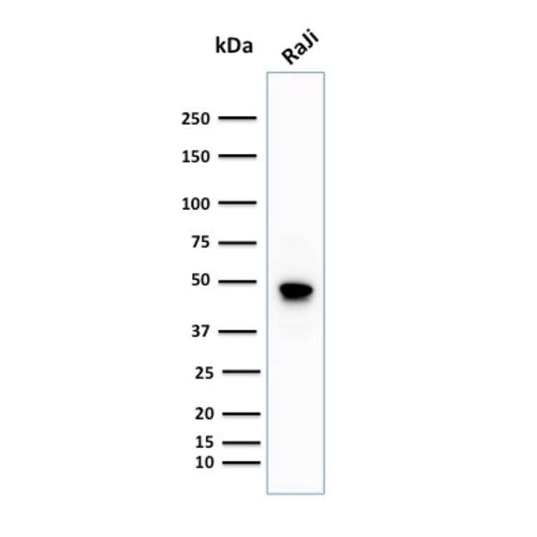 Western Blot - Anti-CD79a Antibody [IGA/1688R] - BSA and Azide free (A253972) - Antibodies.com