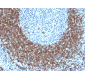 Immunohistochemistry - Anti-CD79b Antibody [IGB/1842] - BSA and Azide free (A253973) - Antibodies.com