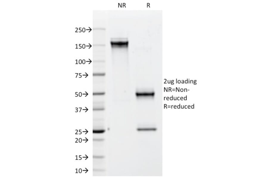 SDS-PAGE - Anti-CD79b Antibody [IGB/1842] - BSA and Azide free (A253974) - Antibodies.com