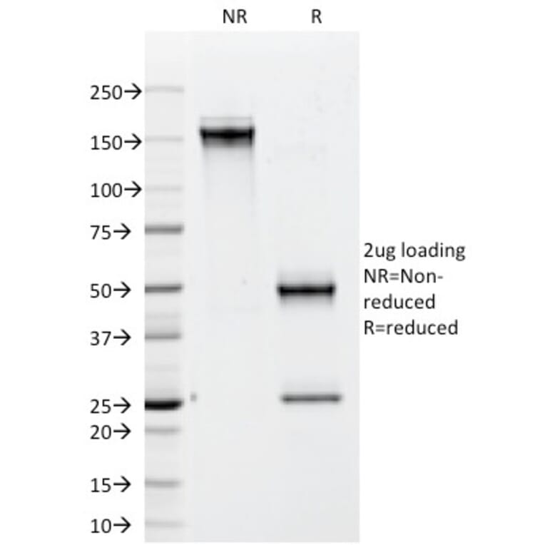 SDS-PAGE - Anti-CD79b Antibody [IGB/1842] - BSA and Azide free (A253974) - Antibodies.com