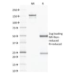 SDS-PAGE - Anti-CD79b Antibody [IGB/1843] - BSA and Azide free (A253974) - Antibodies.com