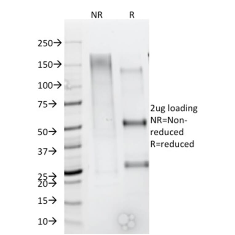 SDS-PAGE - Anti-CD79b Antibody [IGB/1844] - BSA and Azide free (A253976) - Antibodies.com