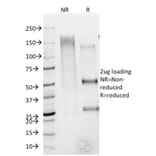 SDS-PAGE - Anti-CD79b Antibody [IGB/1844] - BSA and Azide free (A253976) - Antibodies.com