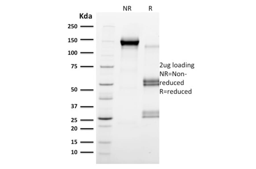 SDS-PAGE - Anti-CD79b Antibody [IGB/2555] - BSA and Azide free (A253977) - Antibodies.com