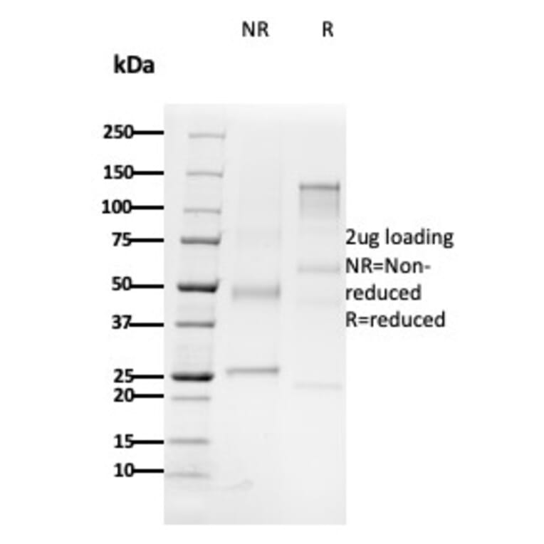 SDS-PAGE - Anti-CD79b Antibody [B29/123] - BSA and Azide free (A253978) - Antibodies.com