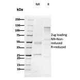 SDS-PAGE - Anti-CD79b Antibody [B29/123] - BSA and Azide free (A253978) - Antibodies.com