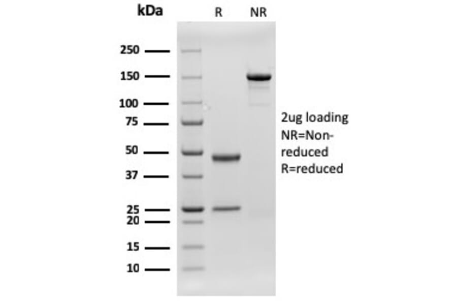 SDS-PAGE - Anti-CD79b Antibody [rIGB/1842] - BSA and Azide free (A253978) - Antibodies.com
