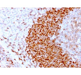 Immunohistochemistry - Anti-CD79b Antibody [IGB/3170R] - BSA and Azide free (A253980) - Antibodies.com