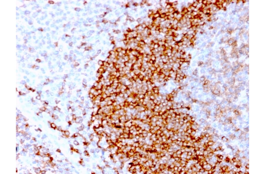Immunohistochemistry - Anti-CD79b Antibody [IGB/3170R] - BSA and Azide free (A253980) - Antibodies.com
