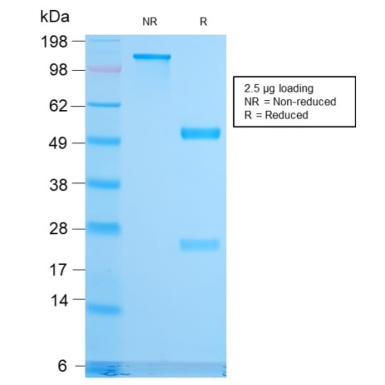 SDS-PAGE - Anti-CD79b Antibody [IGB/3170R] - BSA and Azide free (A253981) - Antibodies.com