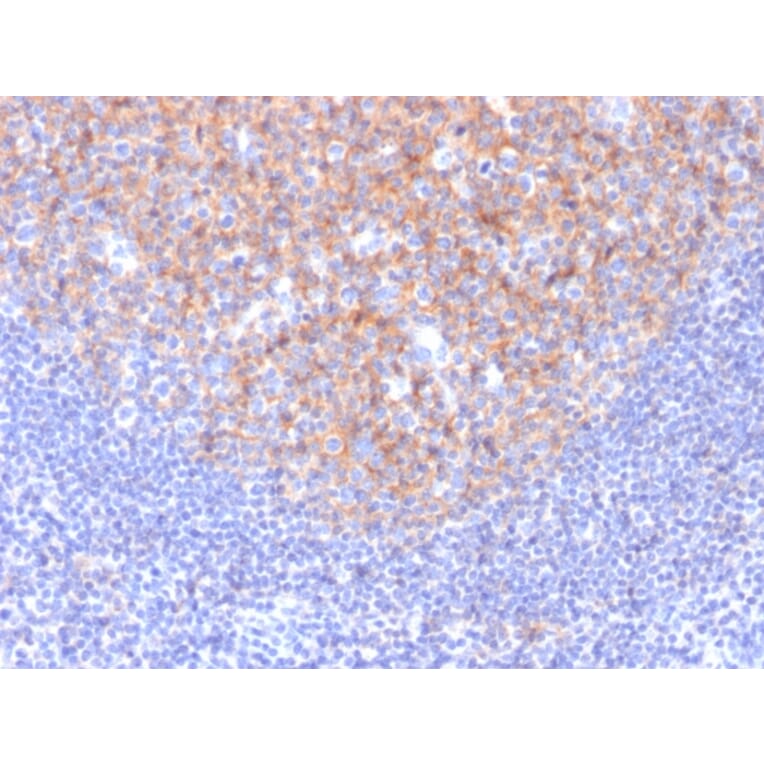 Immunohistochemistry - Anti-TAPA1 Antibody [1.3.3.22] - BSA and Azide free (A253982) - Antibodies.com