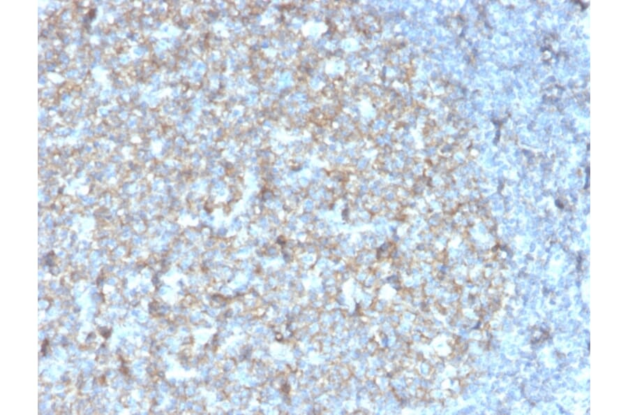 Immunohistochemistry - Anti-TAPA1 Antibody [r1.3.3.22] - BSA and Azide free (A253983) - Antibodies.com